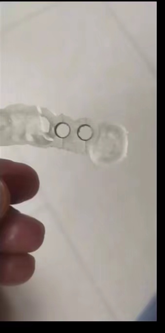 Стоматологический 3D-принтер и – обзор и цена 3D Printing Uv Resin