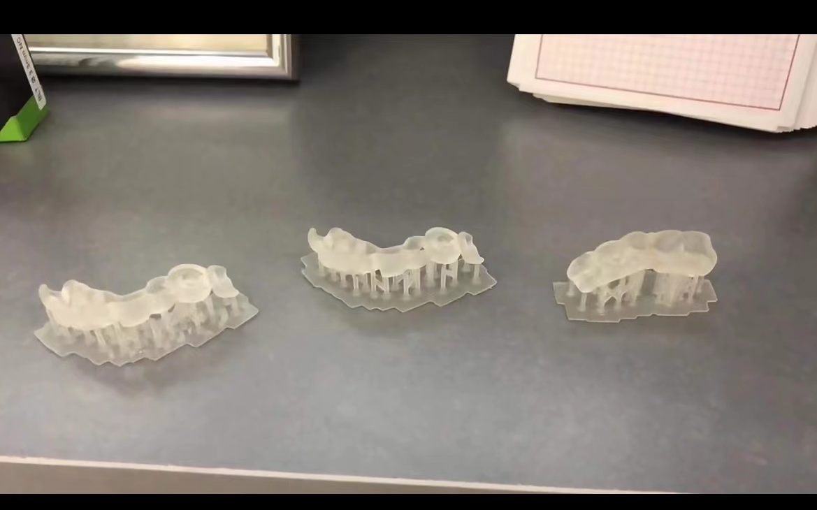 Стоматологический 3D-принтер и – обзор и цена 3D Printing Uv Resin